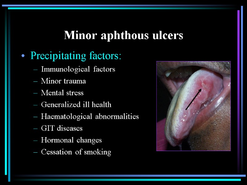 Minor aphthous ulcers Precipitating factors: Immunological factors Minor trauma Mental stress Generalized ill health